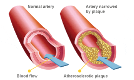 Healthy vs. smoker's blood flow to the penis